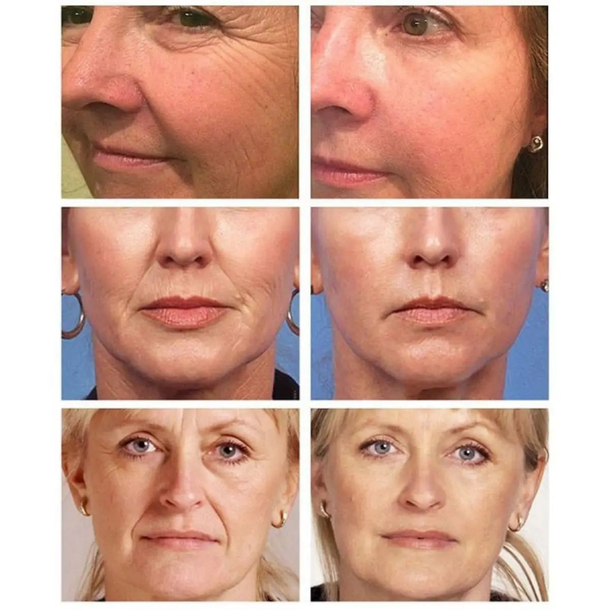 Retinol Brightening Face Cream