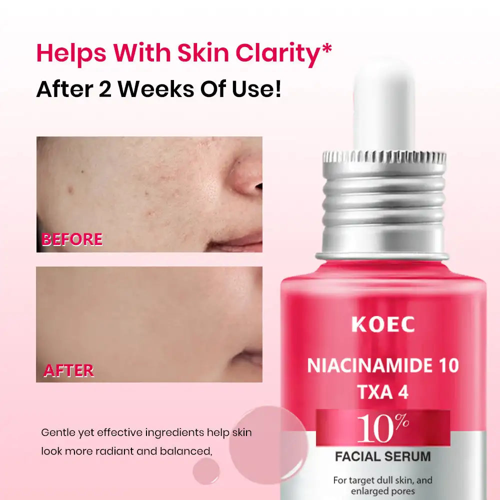 Niacinamide Brightening Serum