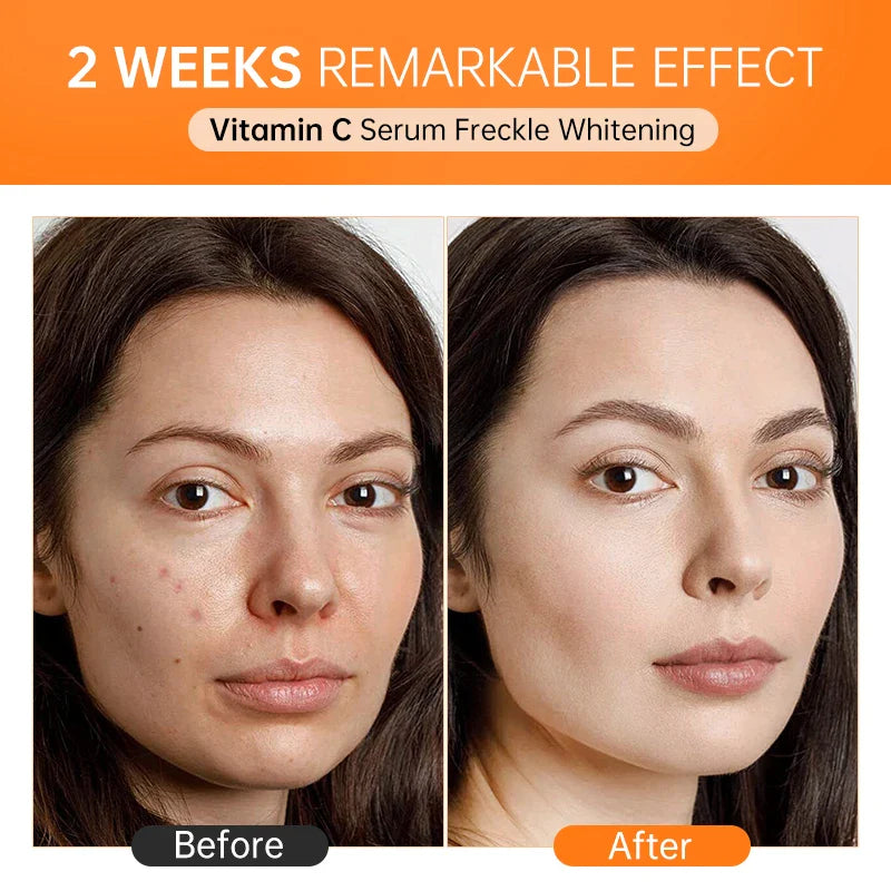 Vitamin C Glow Serum