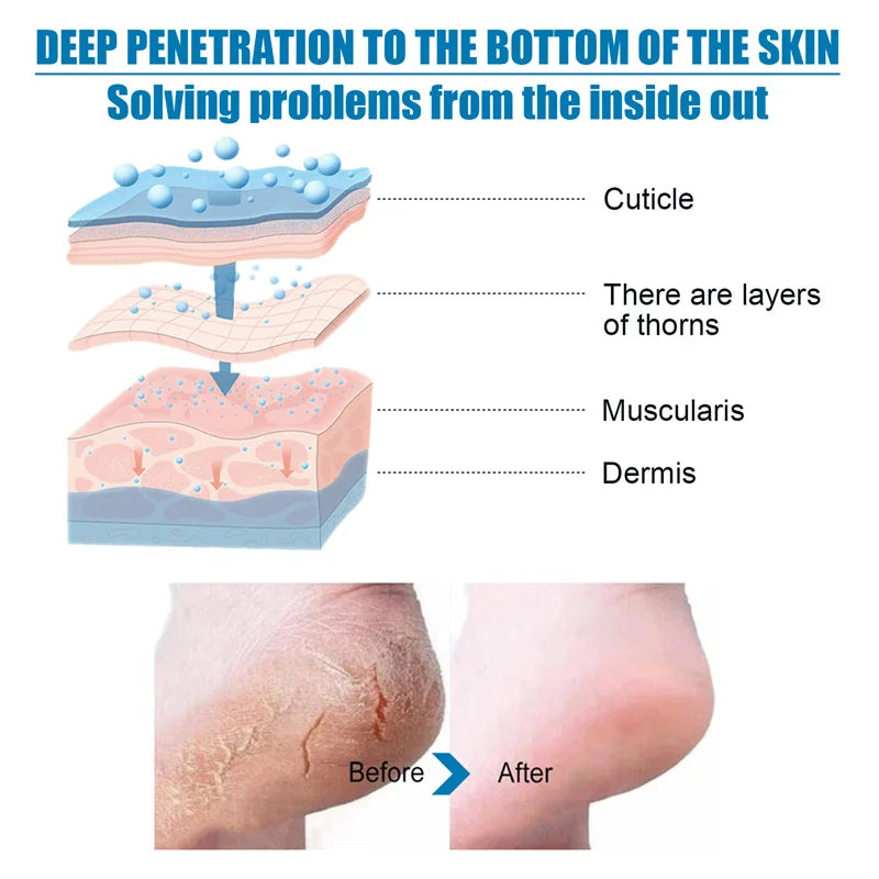 Exfoliating Foot Peeling Mask