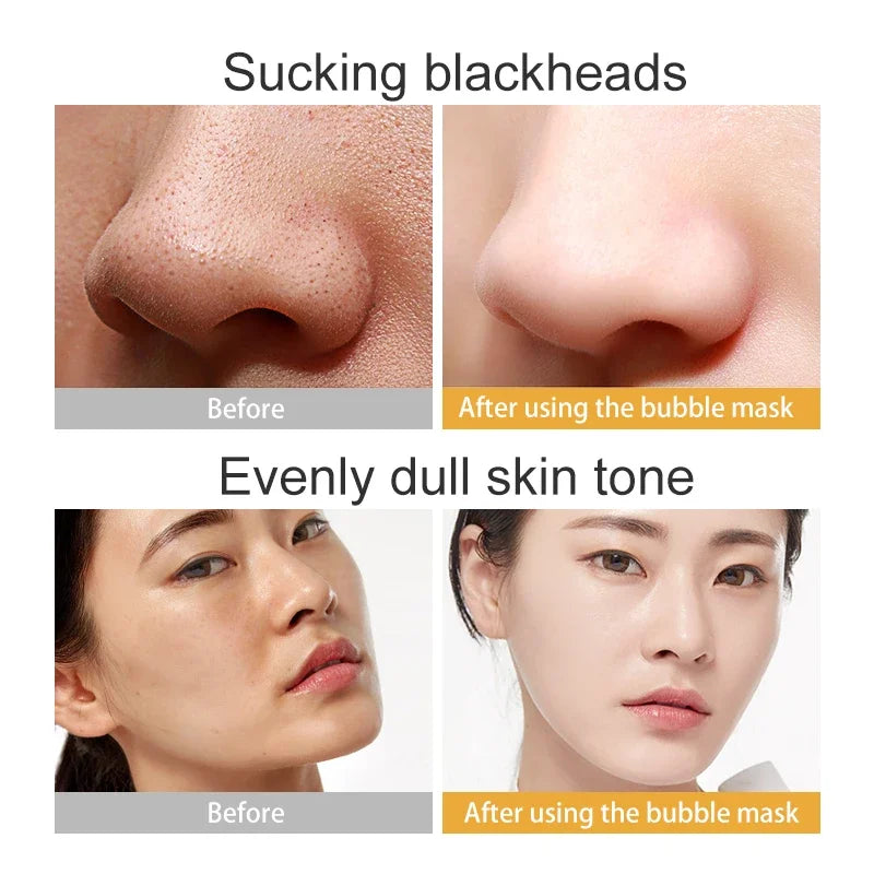 Bamboo Charcoal Bubble Mask