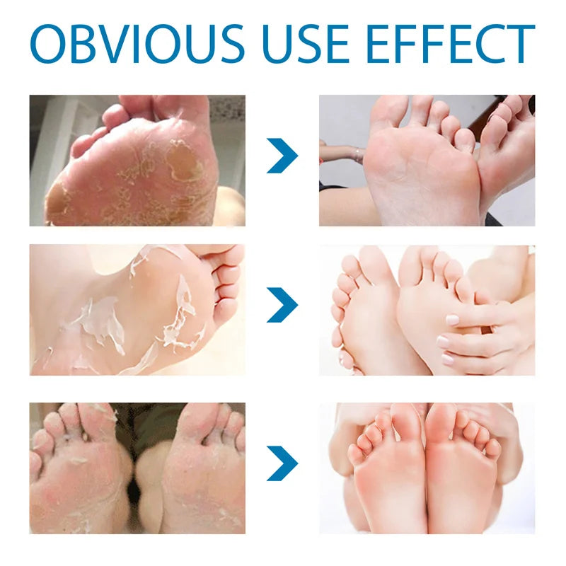 Exfoliating Foot Peeling Mask