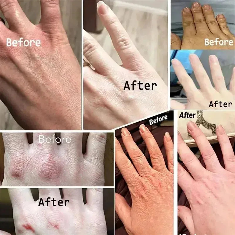 Anti Crack Hand Cream