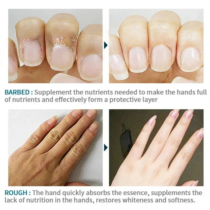 Anti Crack Hand Cream